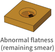 Abnormal flatness (remaining smear)